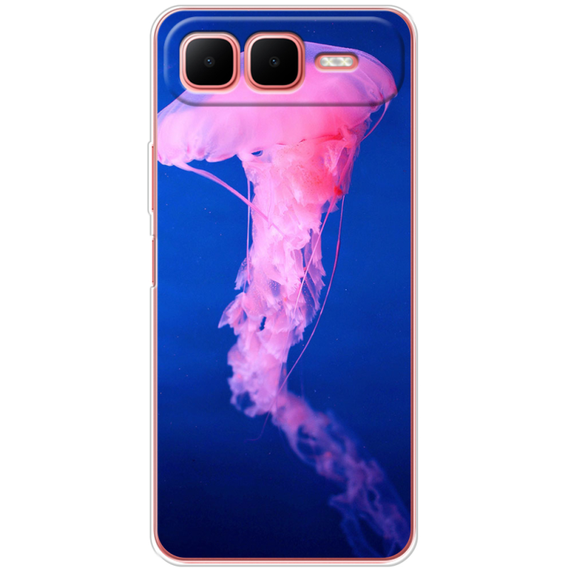 Чохол BoxFace Infinix Smart 10 Plus 