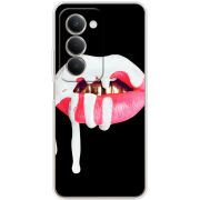 Чохол BoxFace Xiaomi Redmi 15 