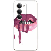 Чохол BoxFace Xiaomi Redmi 15 