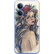 Чохол BoxFace Xiaomi Redmi 15C 