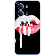 Чохол BoxFace Xiaomi Redmi 15C 