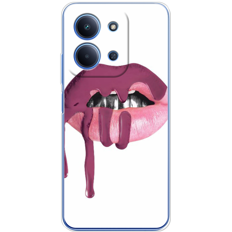 Чохол BoxFace Xiaomi Redmi 15C 