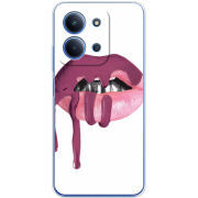 Чохол BoxFace Xiaomi Redmi 15C 
