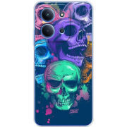 Чохол BoxFace Xiaomi Redmi 15C 