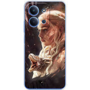 Чохол BoxFace Xiaomi Redmi 15C 