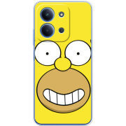 Чохол BoxFace Xiaomi Redmi 15C 