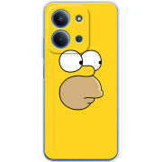 Чохол BoxFace Xiaomi Redmi 15C 