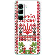 Чохол BoxFace Infinix Hot 60i 