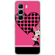 Чохол BoxFace Infinix Hot 60i 