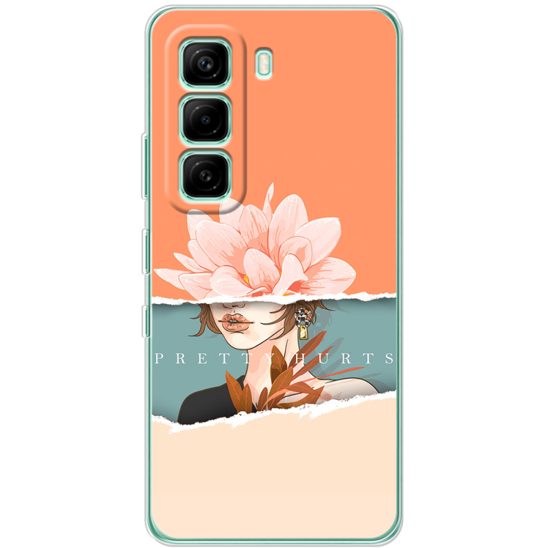 Чохол BoxFace Infinix Hot 60i 