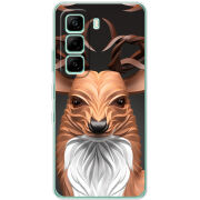 Чохол BoxFace Infinix Hot 60i 