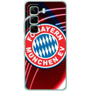 Чохол BoxFace Infinix Hot 60i 