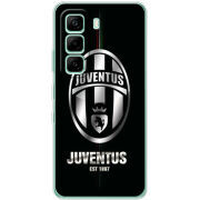 Чохол BoxFace Infinix Hot 60i 