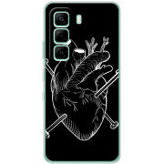 Чохол BoxFace Infinix Hot 60i 