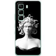 Чохол BoxFace Infinix Hot 60i 