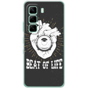 Чохол BoxFace Infinix Hot 60i 