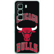 Чохол BoxFace Infinix Hot 60i 