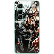 Чохол BoxFace Infinix Hot 60i 