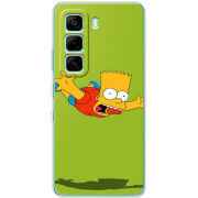 Чохол BoxFace Infinix Hot 60i 