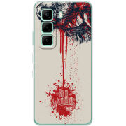 Чохол BoxFace Infinix Hot 60i 