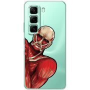 Прозорий чохол BoxFace Infinix Hot 60i Титан