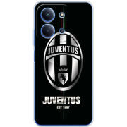 Чохол BoxFace Poco C85 