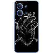 Чохол BoxFace Poco C85 