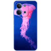 Чохол BoxFace Poco C85 