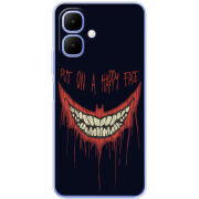 Чохол BoxFace Infinix Smart 10 