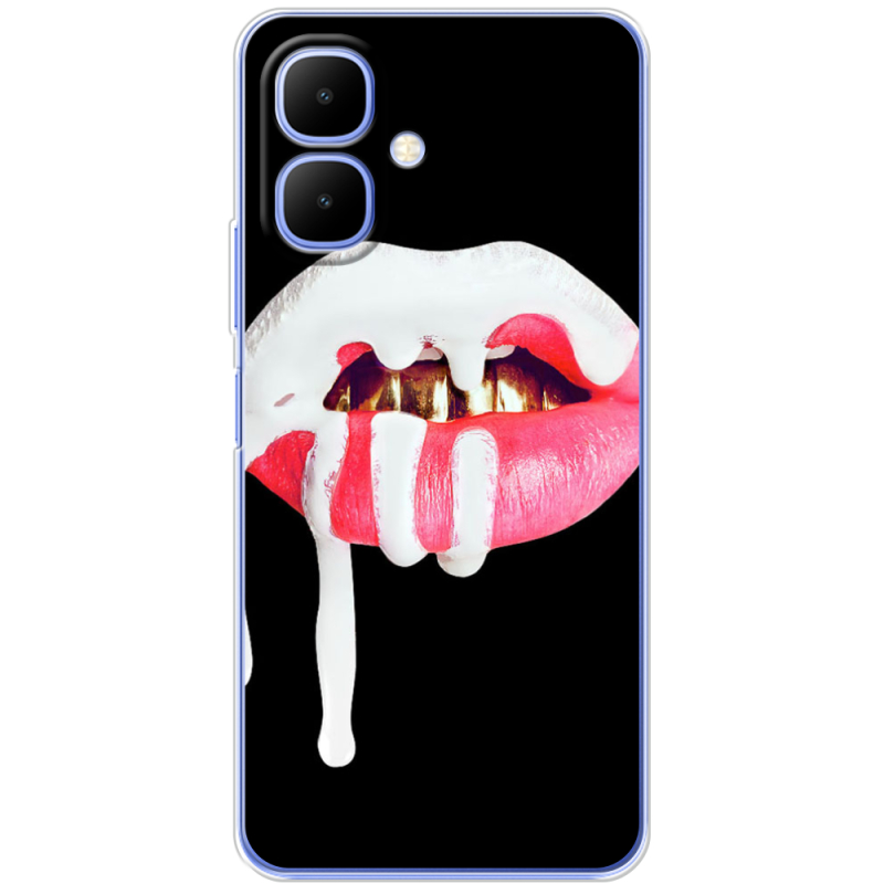 Чохол BoxFace Infinix Smart 10 