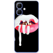 Чохол BoxFace Infinix Smart 10 