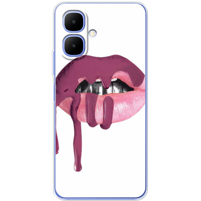 Чохол BoxFace Infinix Smart 10 