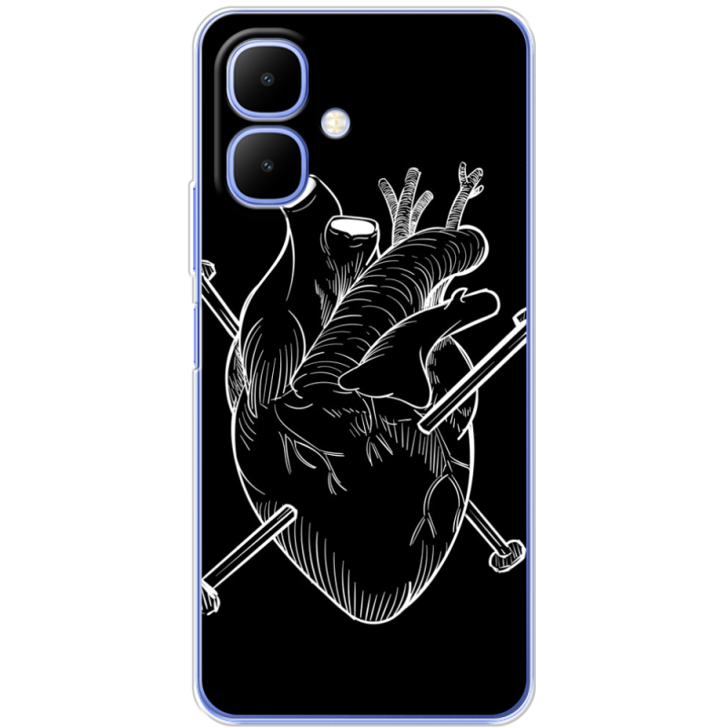 Чохол BoxFace Infinix Smart 10 