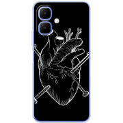 Чохол BoxFace Infinix Smart 10 