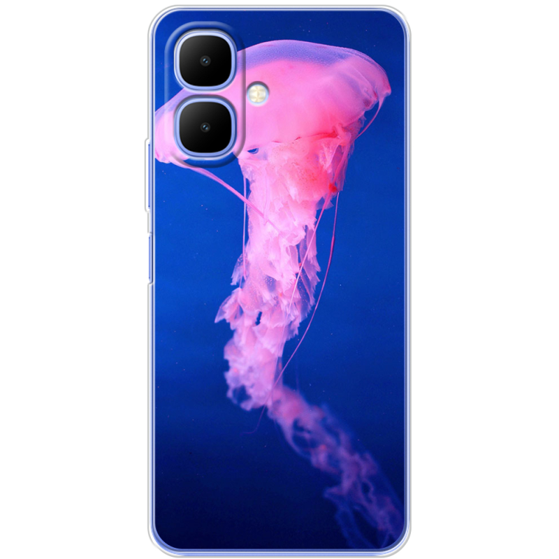 Чохол BoxFace Infinix Smart 10 