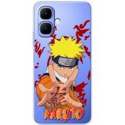Прозорий чохол BoxFace Infinix Smart 10 Naruto