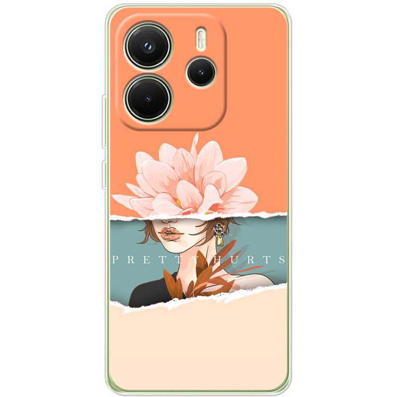 Чохол BoxFace Xiaomi Redmi Note 14 4G Global version 