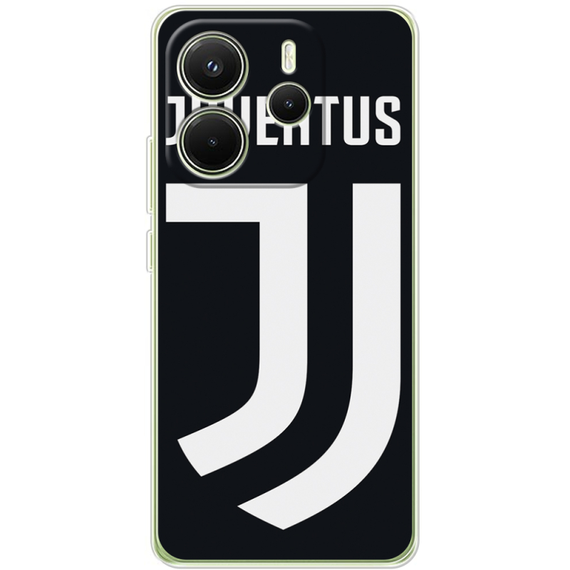 Чохол BoxFace Xiaomi Redmi Note 14 4G Global version FC J