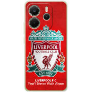 Чохол BoxFace Xiaomi Redmi Note 14 4G Global version 