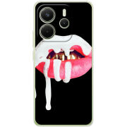 Чохол BoxFace Xiaomi Redmi Note 14 4G Global version 