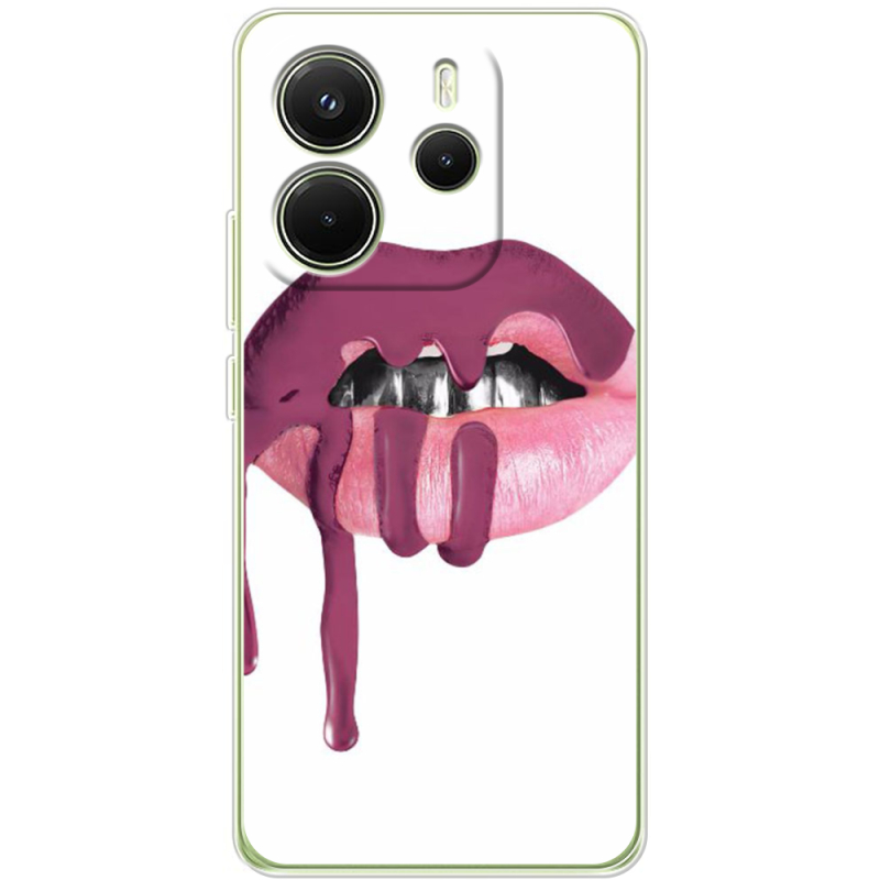 Чохол BoxFace Xiaomi Redmi Note 14 4G Global version 