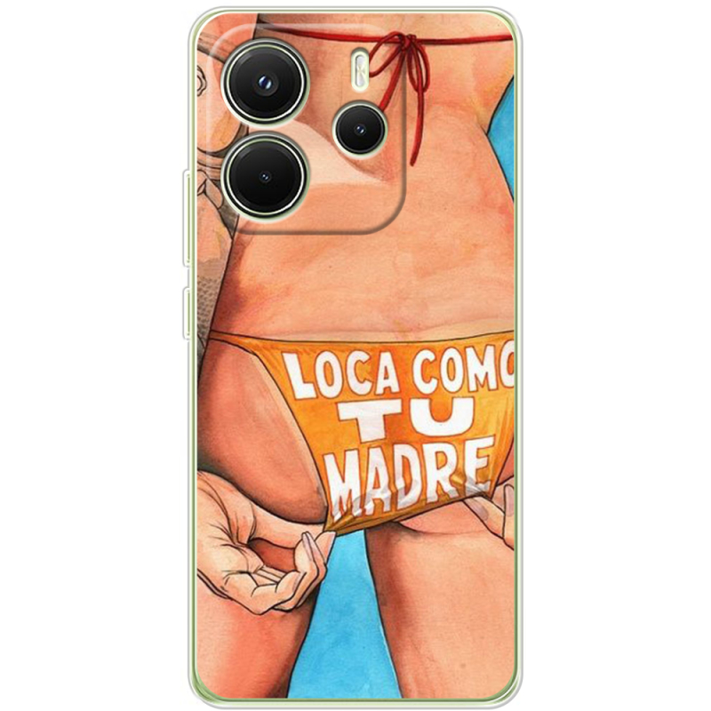 Чохол BoxFace Xiaomi Redmi Note 14 4G Global version 