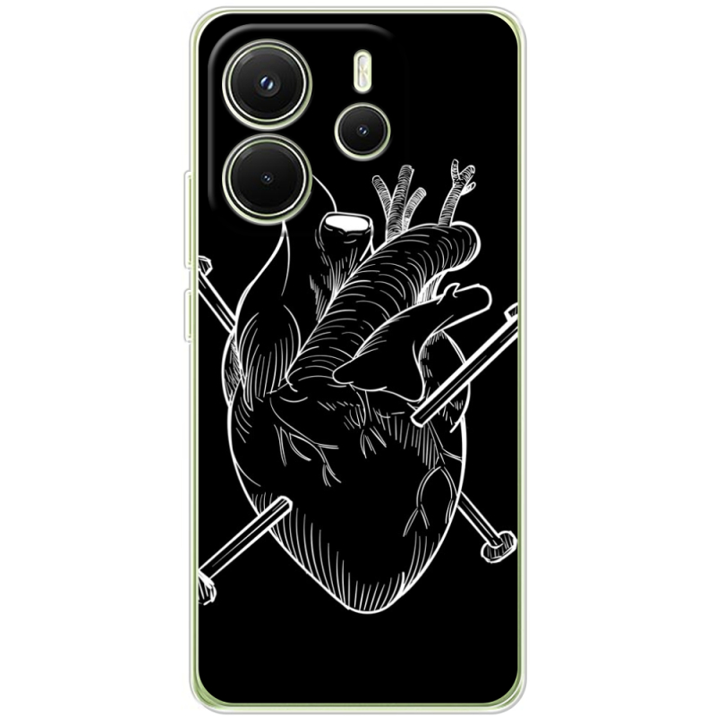 Чохол BoxFace Xiaomi Redmi Note 14 4G Global version 