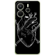 Чохол BoxFace Xiaomi Redmi Note 14 4G Global version 