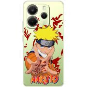 Прозорий чохол BoxFace Xiaomi Redmi Note 14 4G Global version Naruto