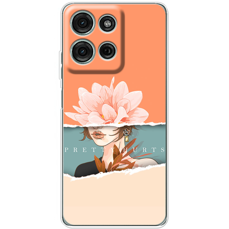 Чохол BoxFace Motorola Moto G56 