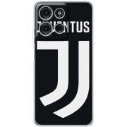 Чохол BoxFace Motorola Moto G56 FC J