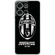 Чохол BoxFace Motorola Moto G56 