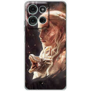 Чохол BoxFace Motorola Moto G56 