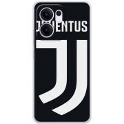 Чохол BoxFace OPPO Reno 14 F FC J